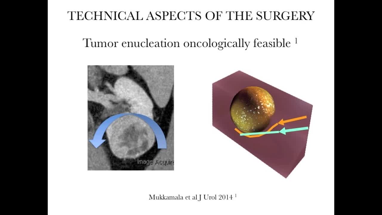 PRESIRES, Preoperative simulation of renal surgery