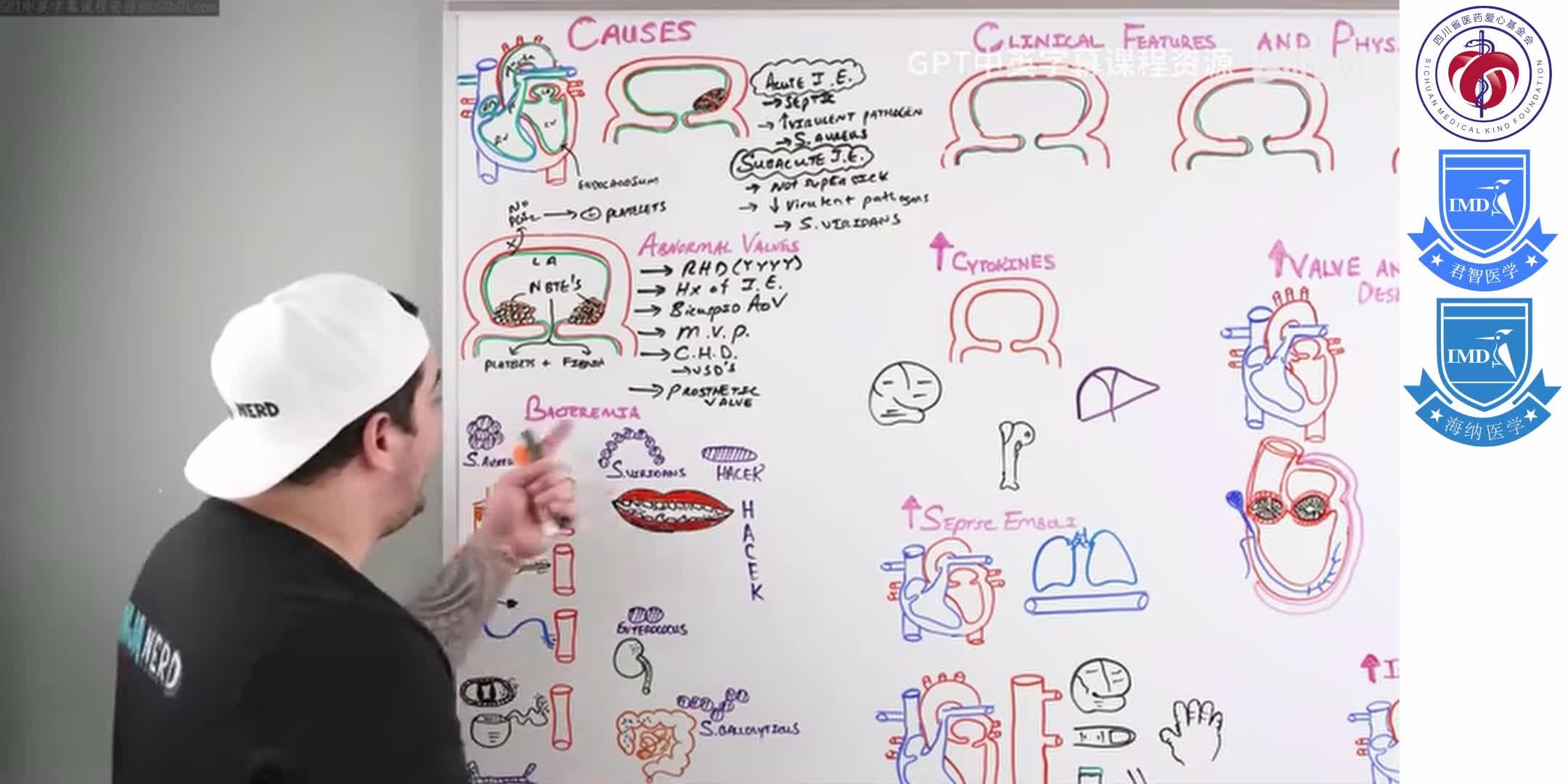 Infective Endocarditis 2