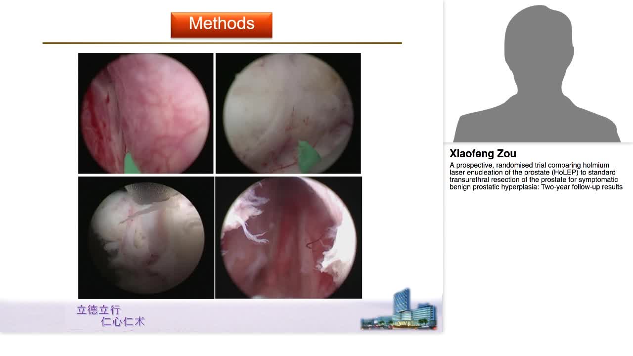 A prospective, randomised trial comparing holmium laser e-