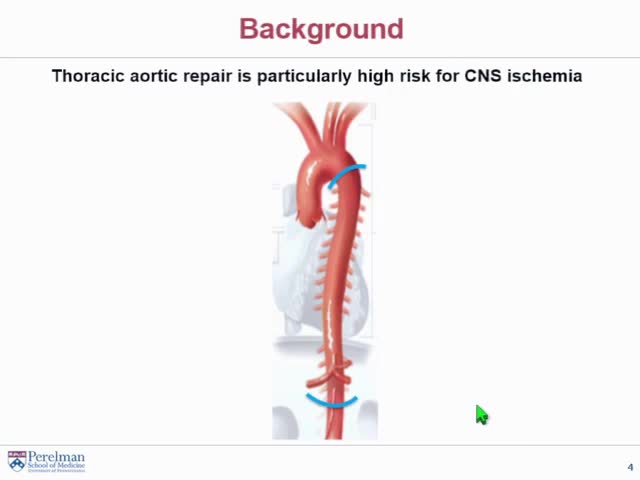 Results from a Multicenter Phase II Randomized Tiral of a Prolyl Hydroxylase Inhibitor for Neuroprotection in High Risk Thoracic