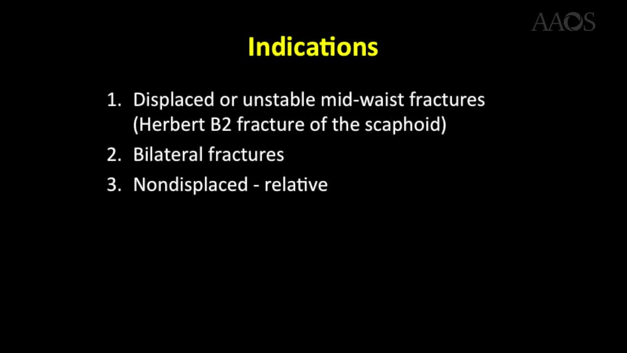 Scaphoid FractureFixation Using aNitinol Staple