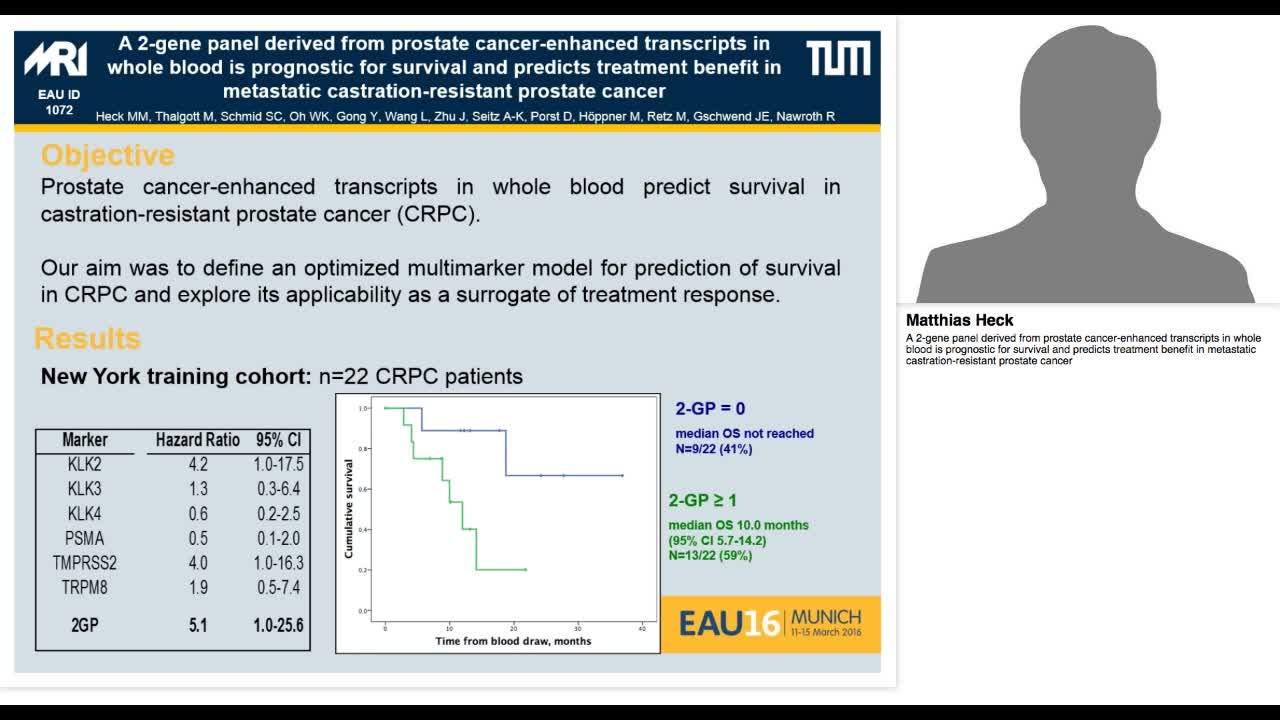 A 2-gene panel derived from prostate cancer-enhanced tran-