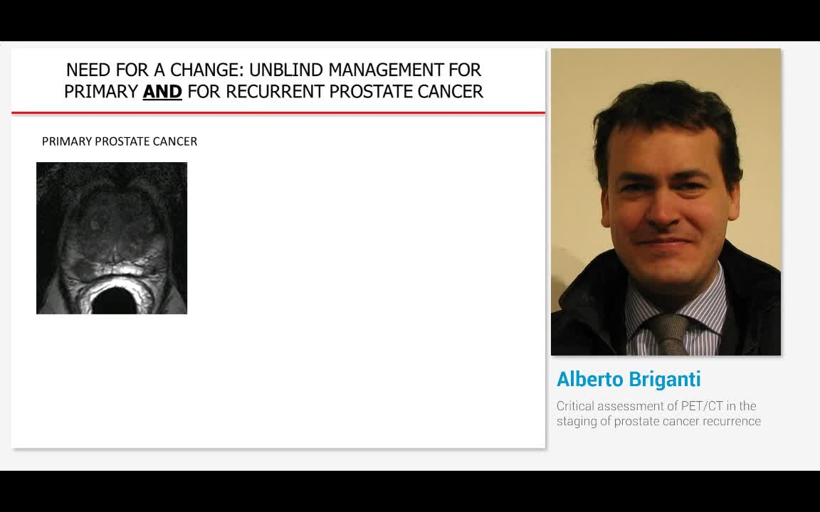 Critical assessment of PET-CT in the staging of prostate ..-