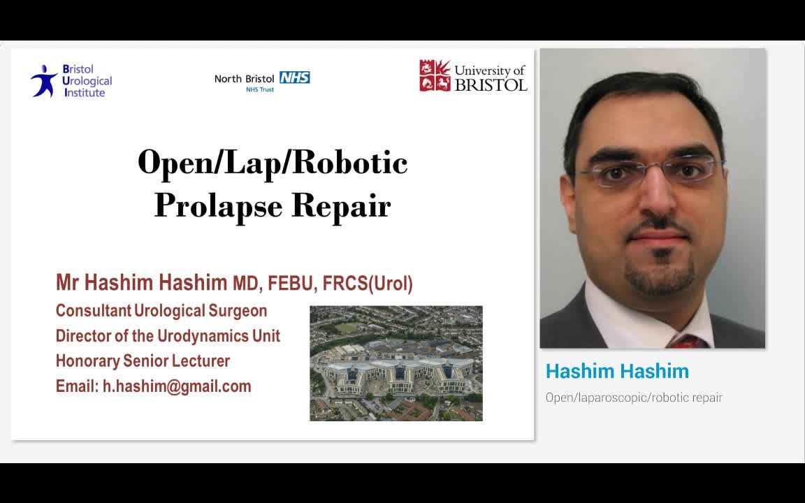 Open-laparoscopic-robotic repair