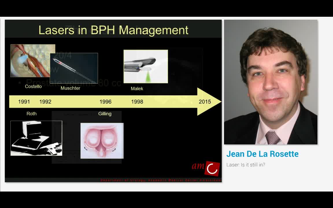 Laser, Is it still in