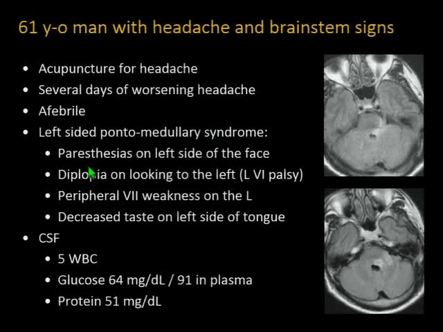 Test Your Knowledge A Case-Based Approach to Neuroimaging