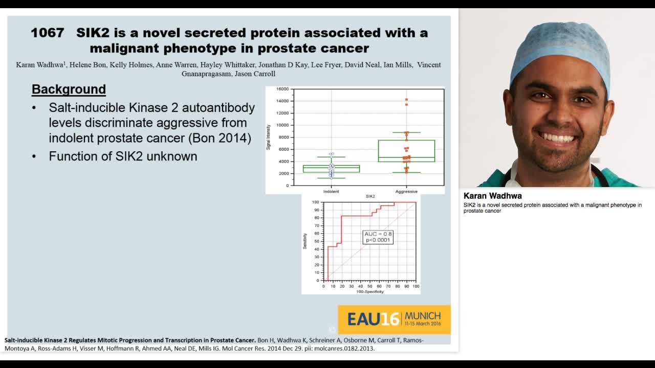 SIK2 is a novel secreted protein associated with a malign-