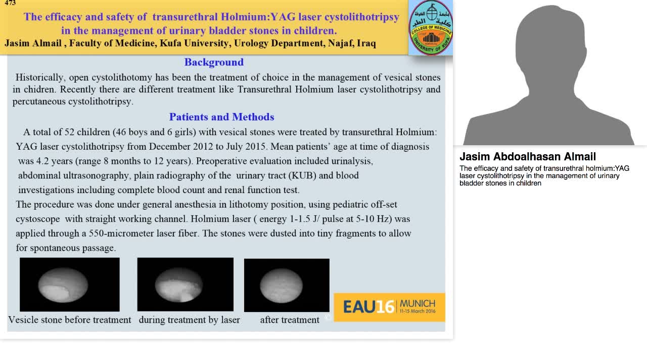 The efficacy and safety of transurethral holmium,YAG lase-