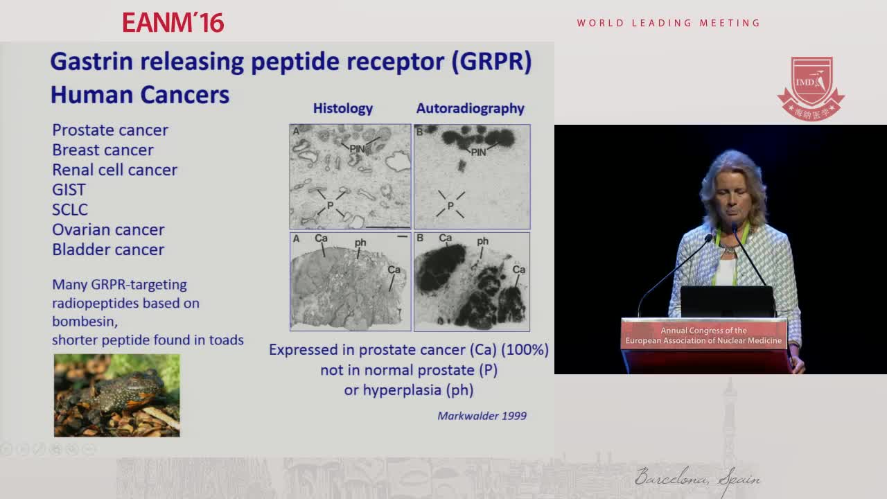 生长抑素受体的治疗潜力4