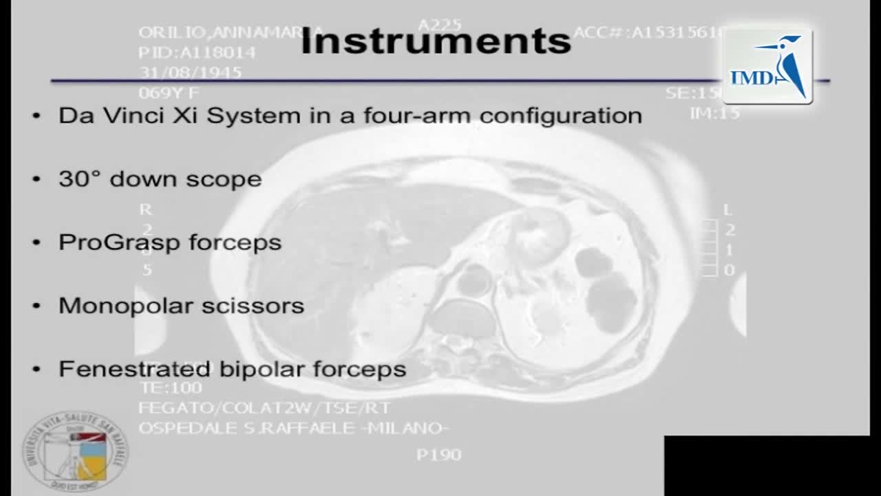 机器人手术治疗体积巨大的嗜络细胞瘤