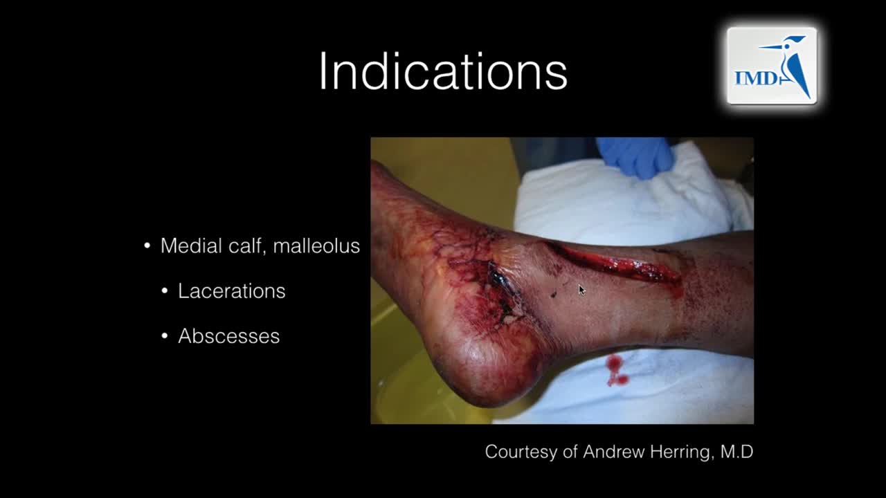 04_下肢神经阻滞