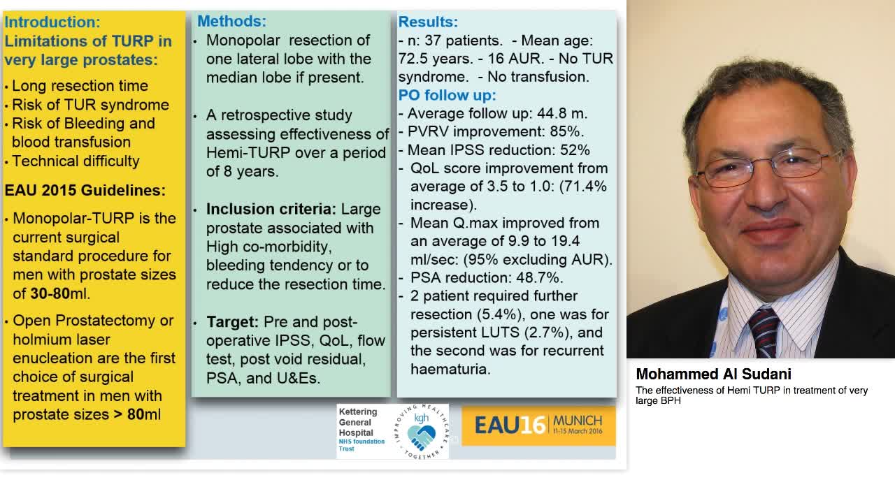 The effectiveness of Hemi TURP in treatment of very large-