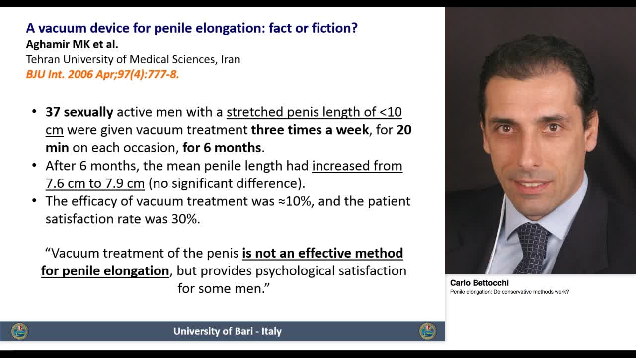 Penile elongation, Do conservative methods work.