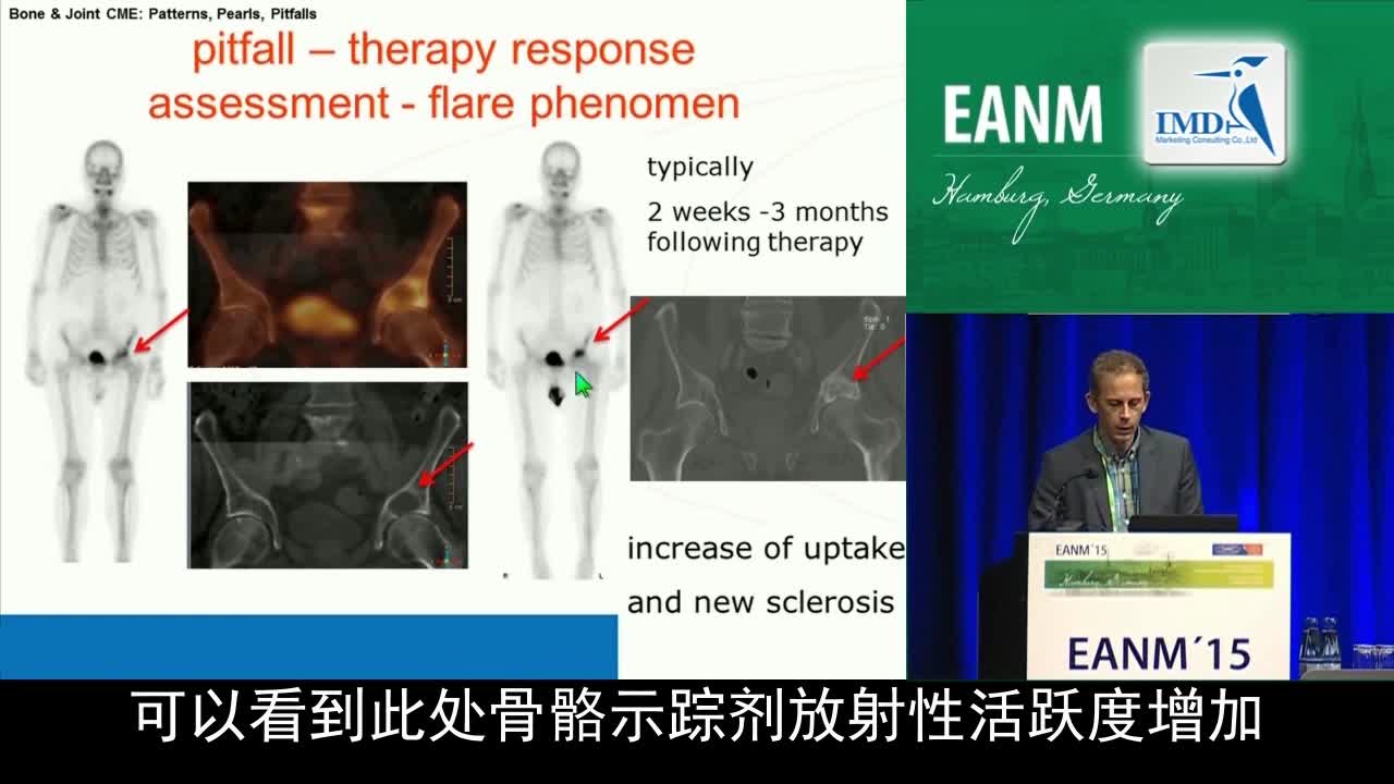 骨骼与关节继续医学教育-误区（4）