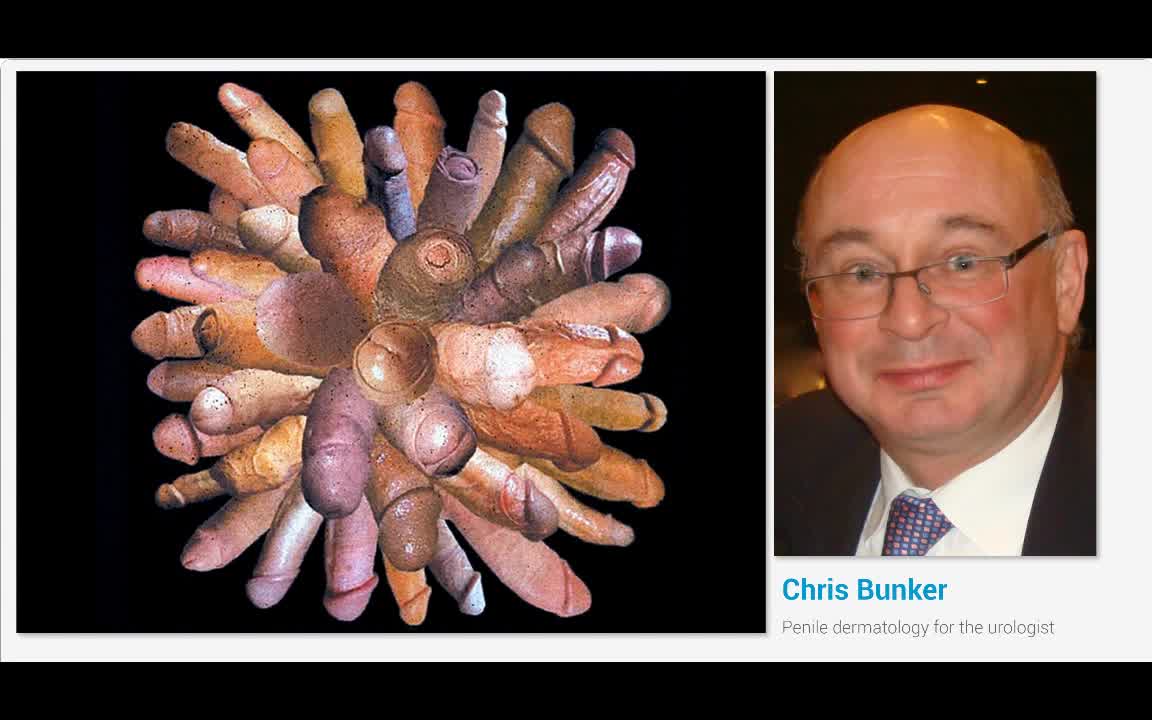 Penile dermatology for the urologist