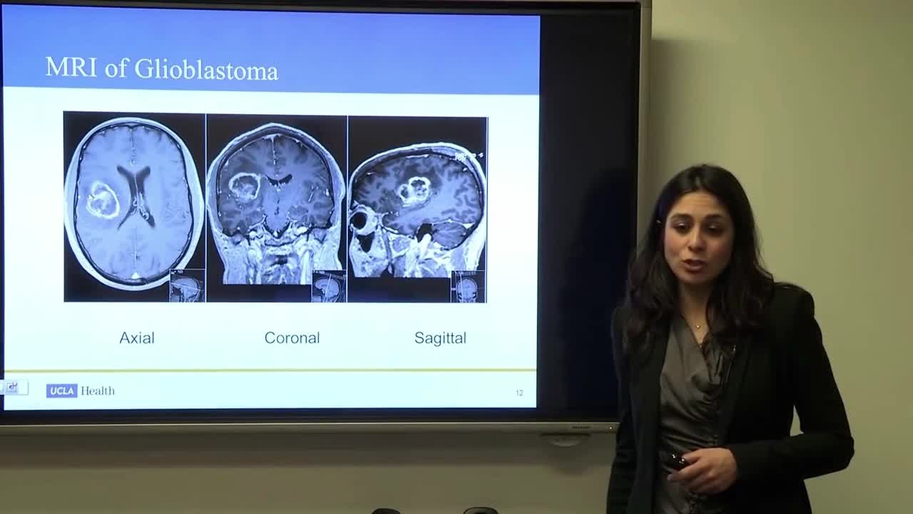 脑瘤放射治疗（2）