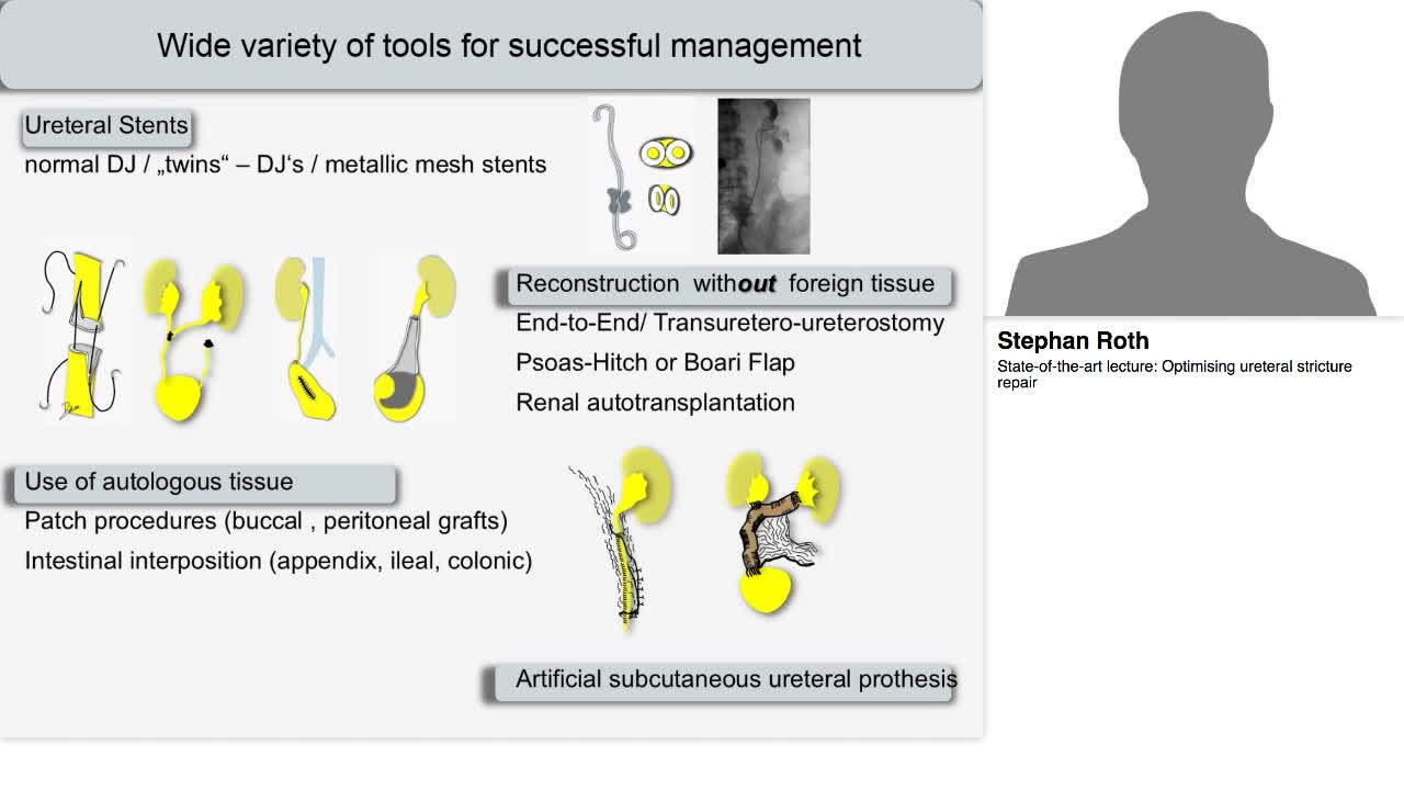 Optimising ureteral stricture repair