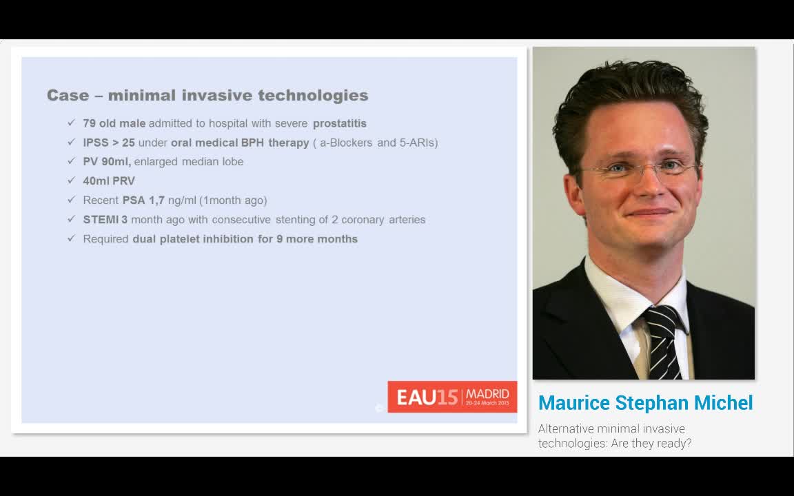 Alternative minimal invasive technologies, Are they ready