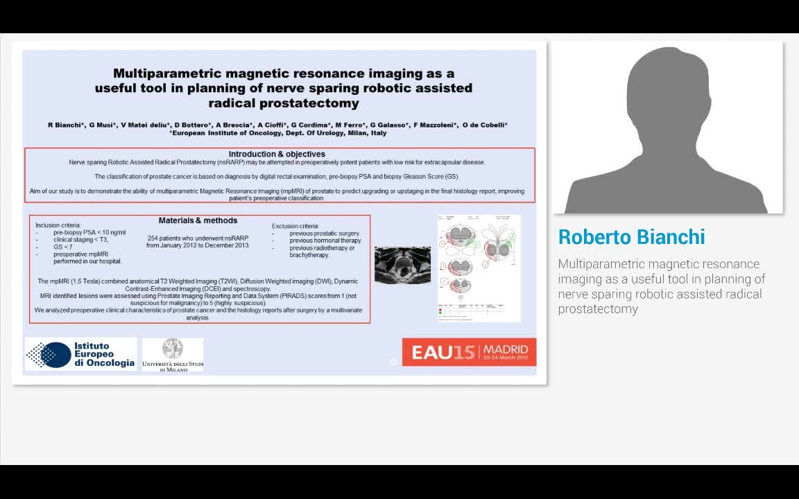 Multiparametric magnetic resonance imaging as a useful to..-