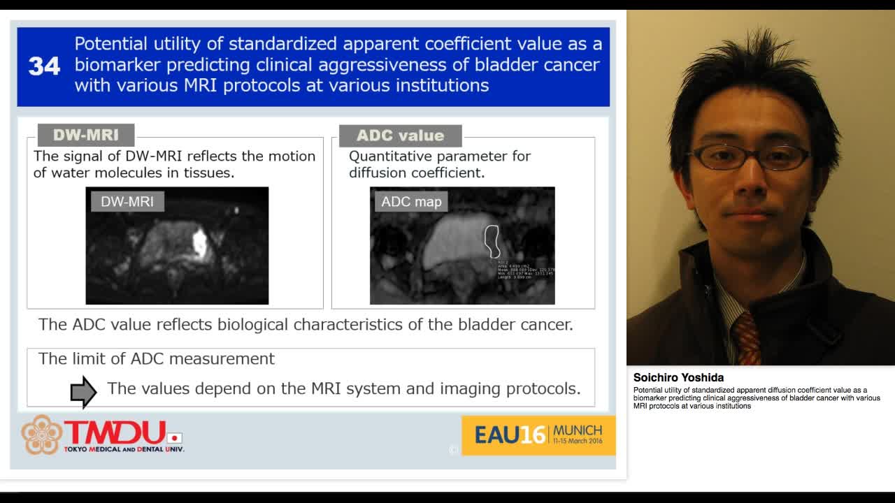 Potential utility of standardized apparent diffusion coef-