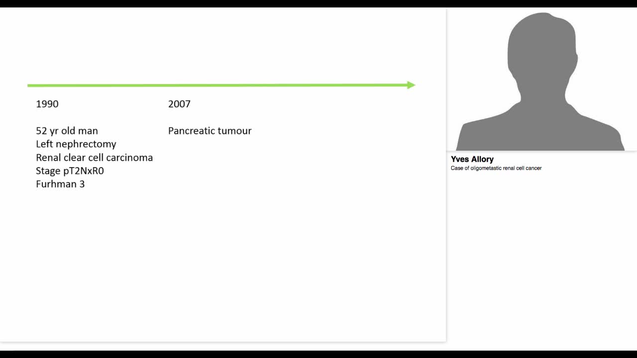 Case of oligometastic renal cell cancer