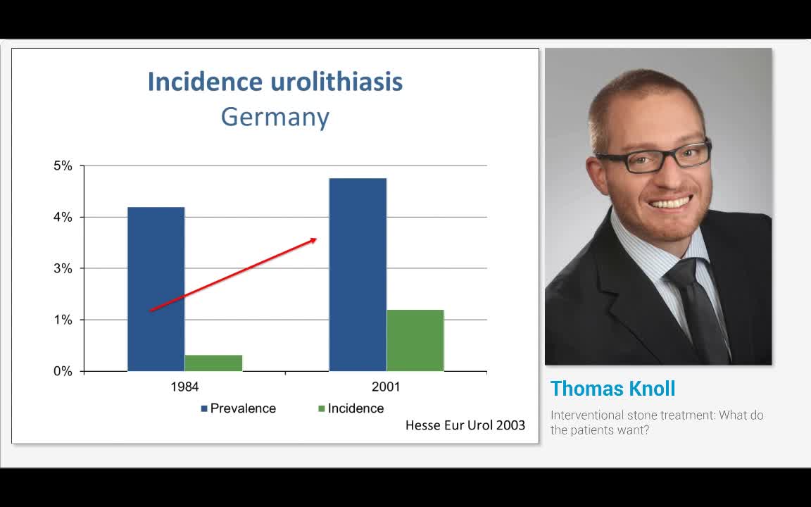 Interventional stone treatment, What do the patients want