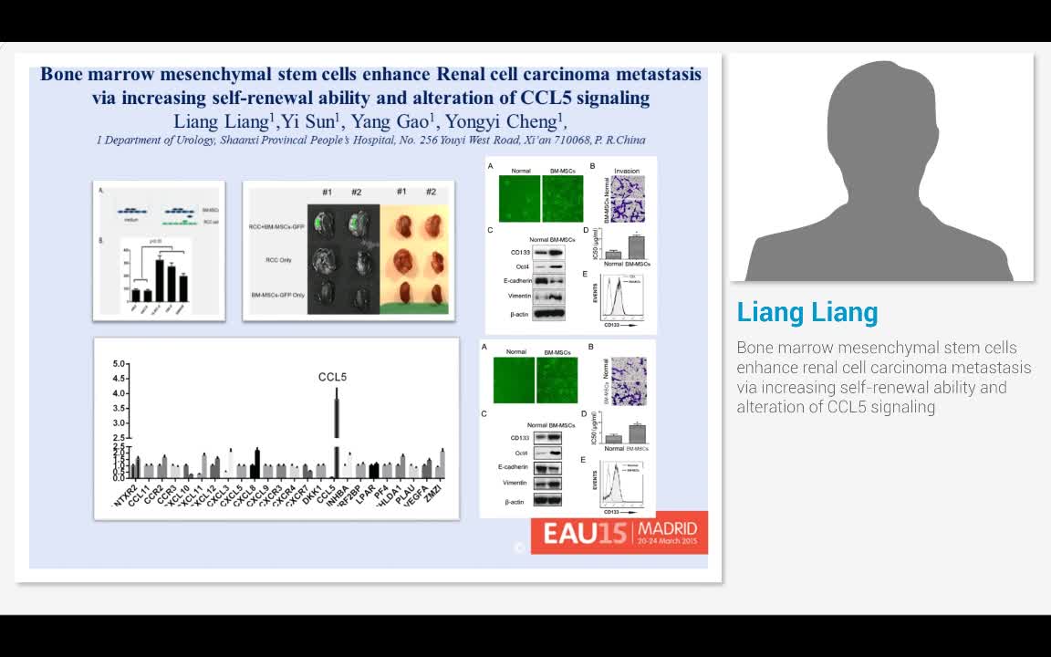Bone marrow mesenchymal stem cells enhance renal cell car..-