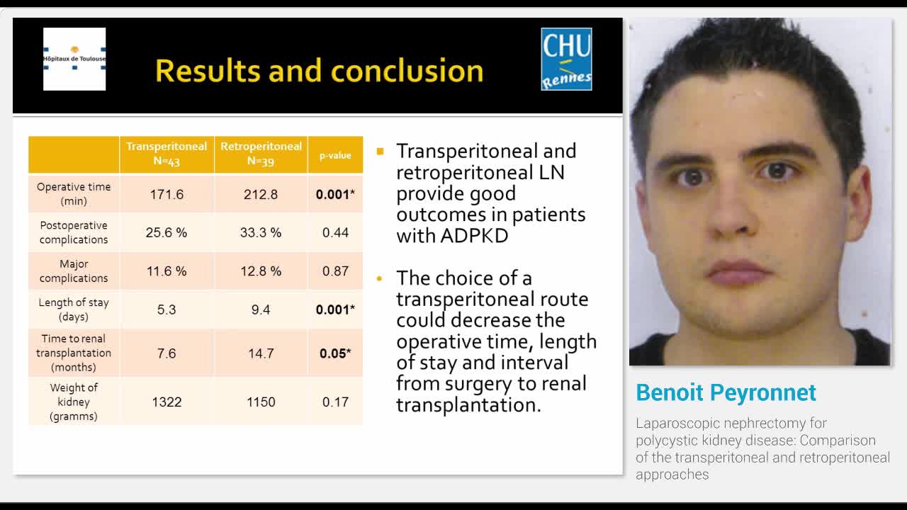 Laparoscopic nephrectomy for polycystic kidney disease, C..-