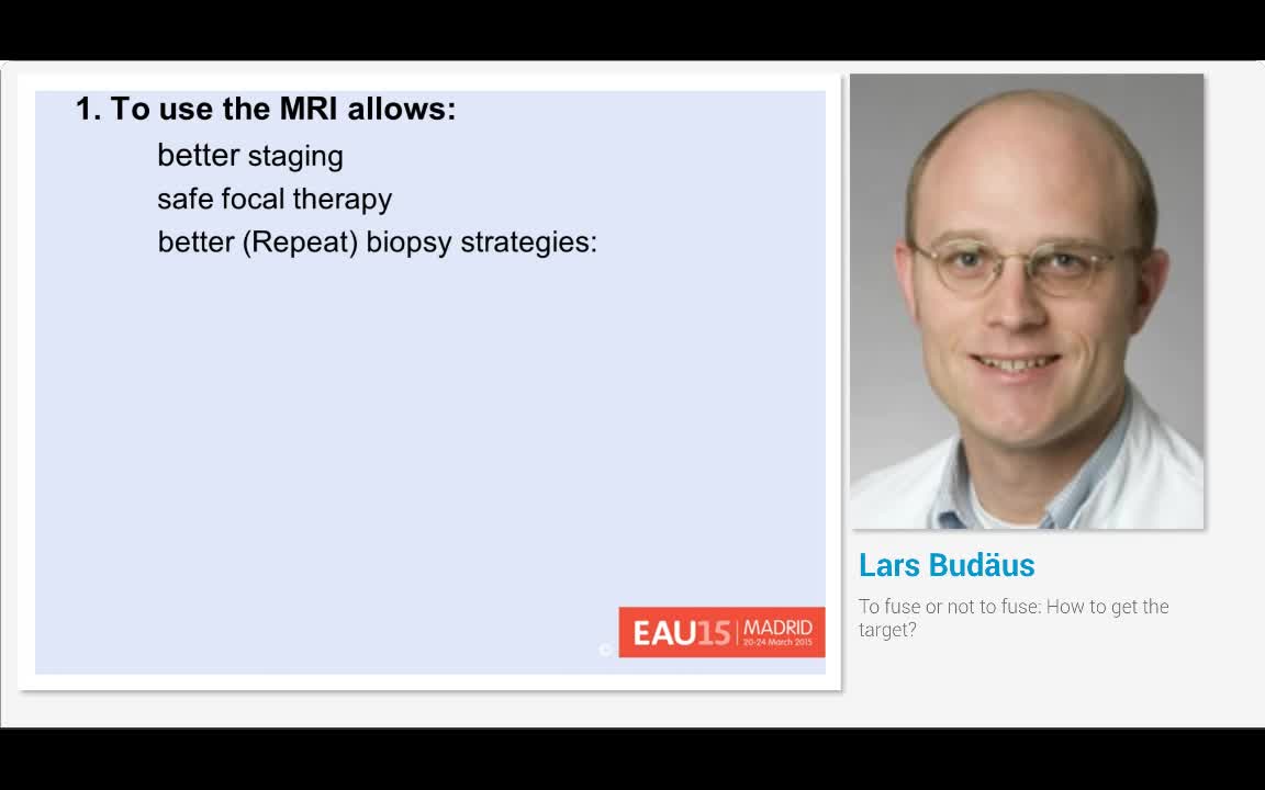 To fuse or not to fuse, How to get the target