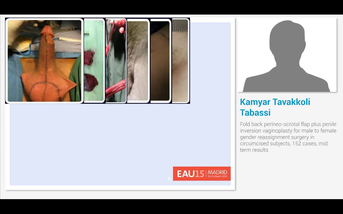 Fold back perineo-scrotal flap plus penile inversion vagi..-