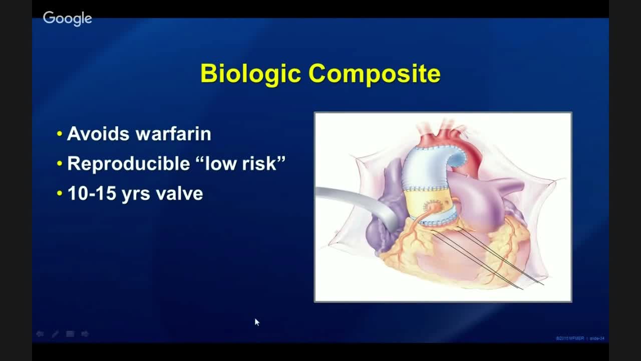 马方综合征的诊断和治疗（3）