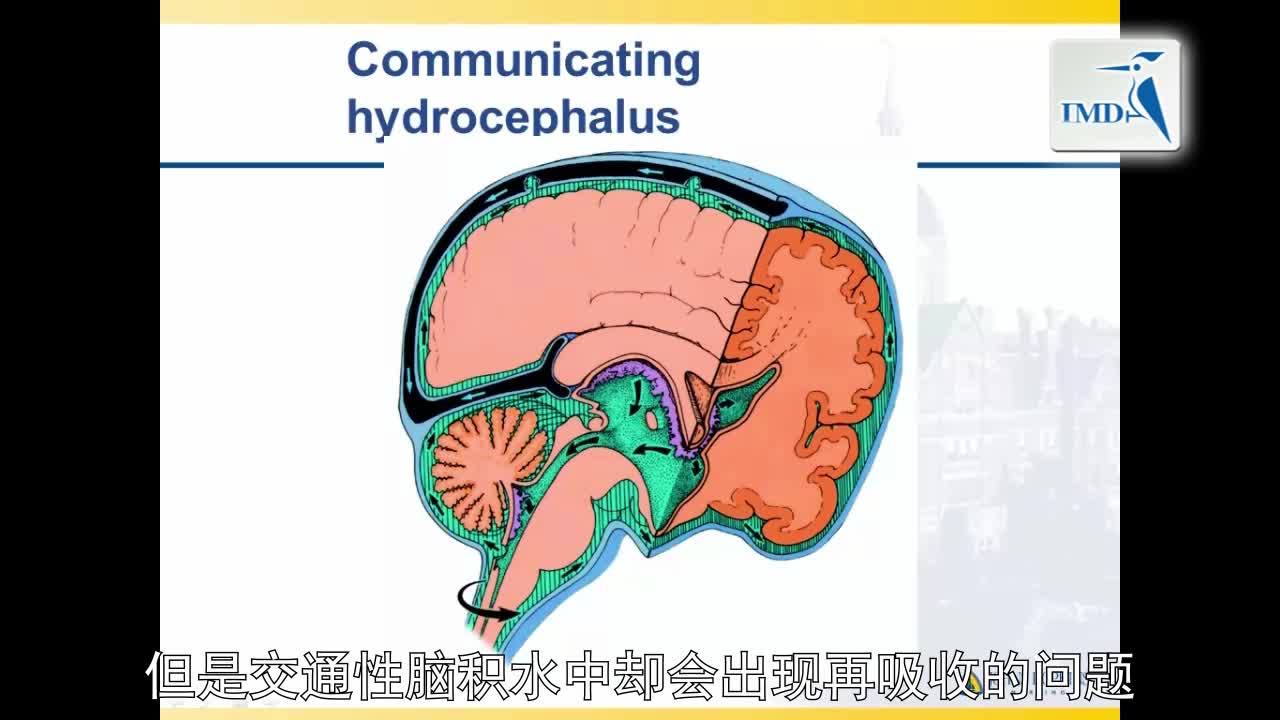 对急性卒中患者的医护管理（12）