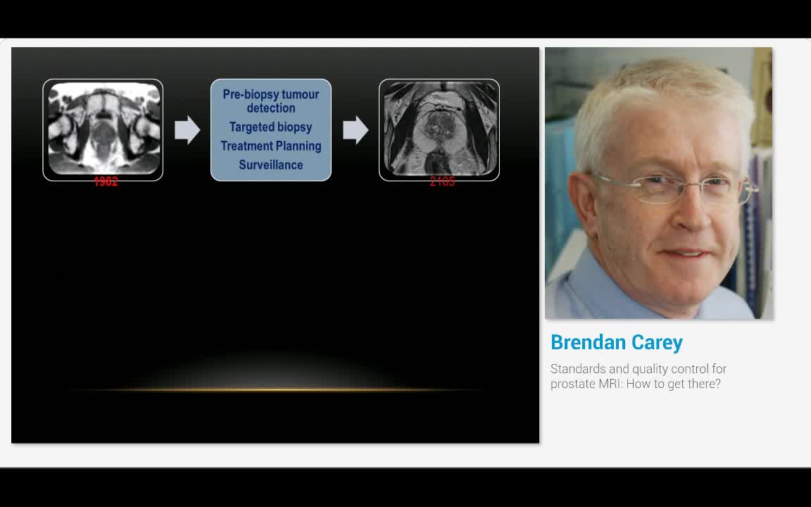 Standards and quality control for prostate MRI, How to ge..-