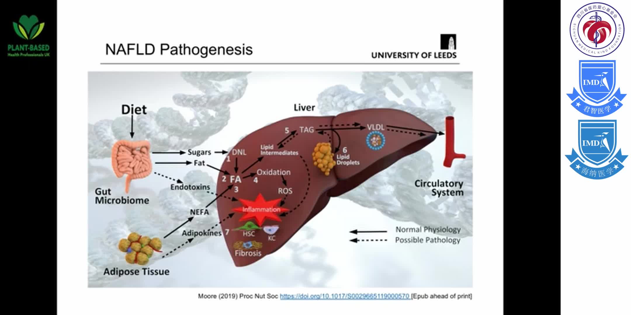 Dr J Bernadetta Moore - Prevention and treatment of non-alcoholic fatty liver di 1-3