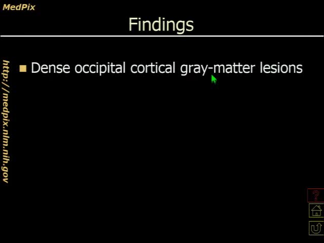 Problem Based Learning