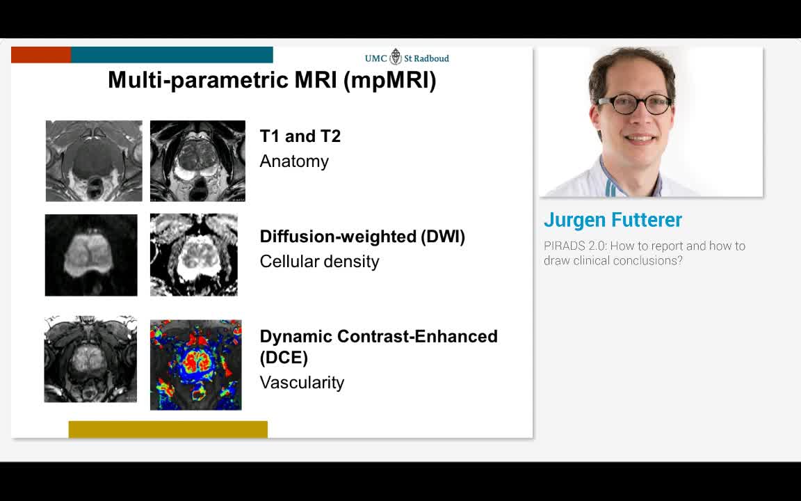 PIRADS 2.0, How to report and how to draw clinical conclu..-