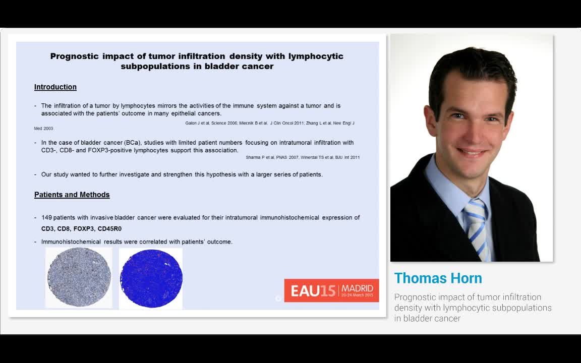 Prognostic impact of tumor infiltration density with lymp..-