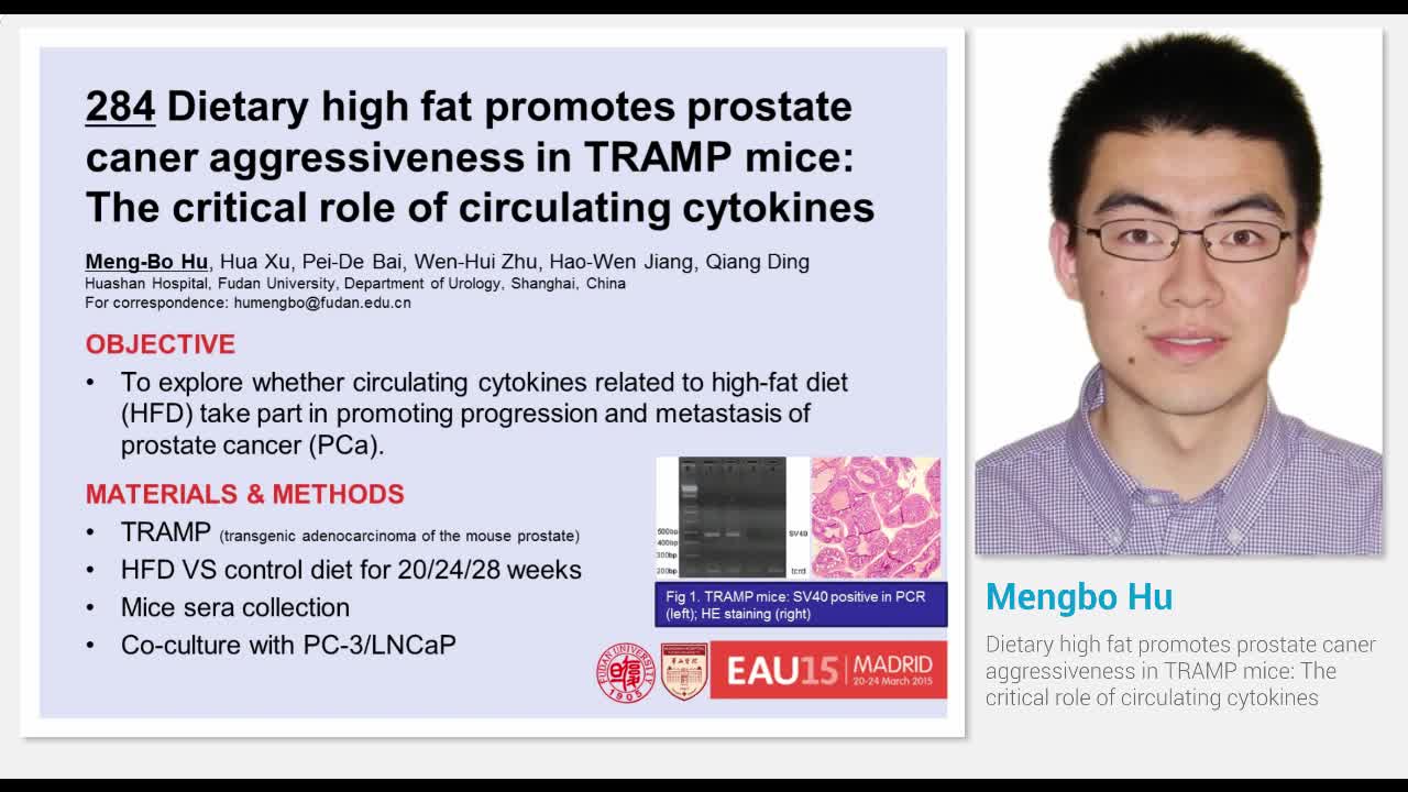 Dietary high fat promotes prostate caner aggressiveness i..-
