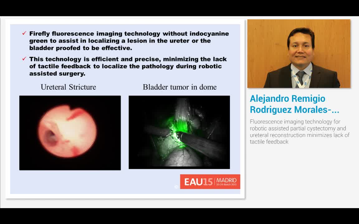 Fluorescence imaging technology for robotic assisted part..-