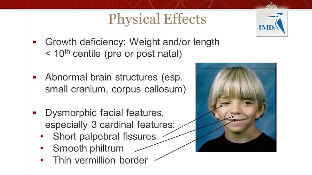 02_妇儿-胎儿酒精证候群