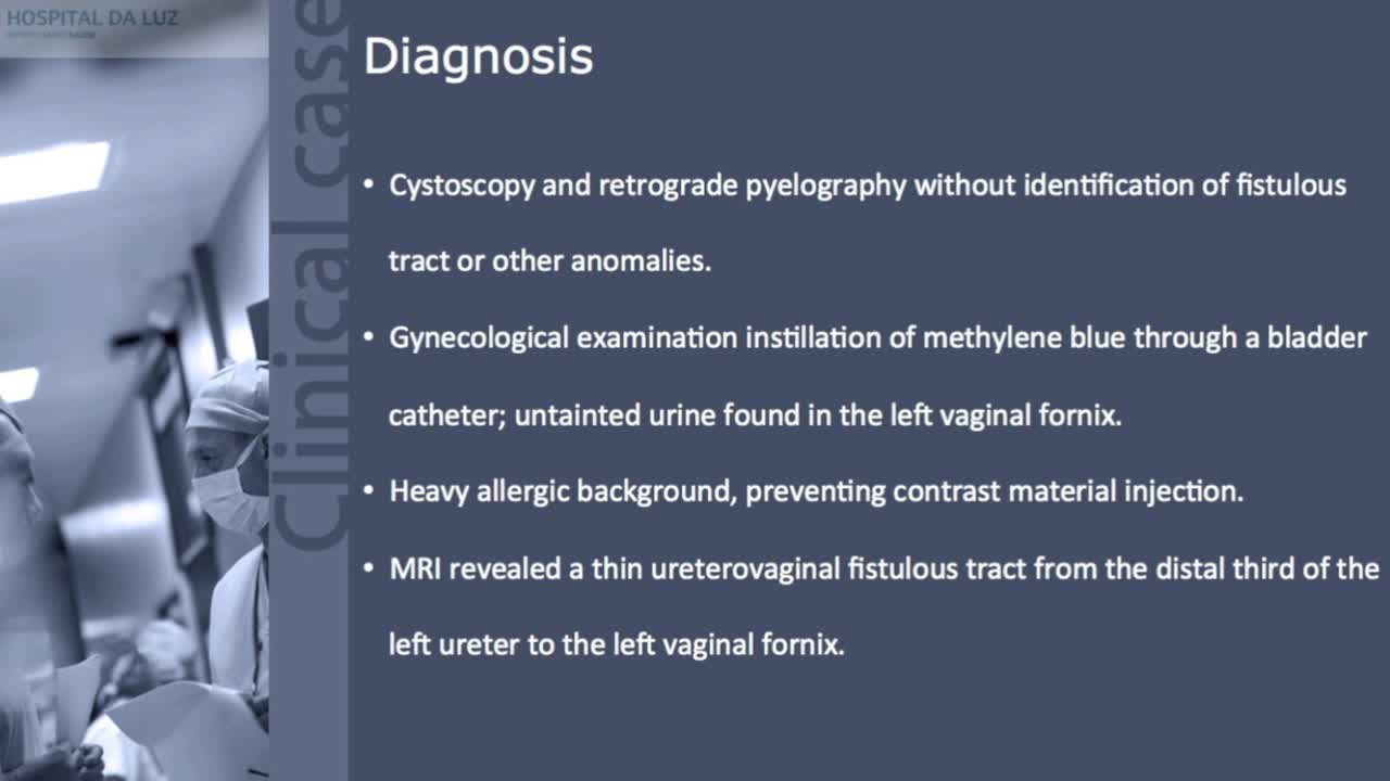 Laparoscopic psoas hitch double ureteral re-implantation ..-