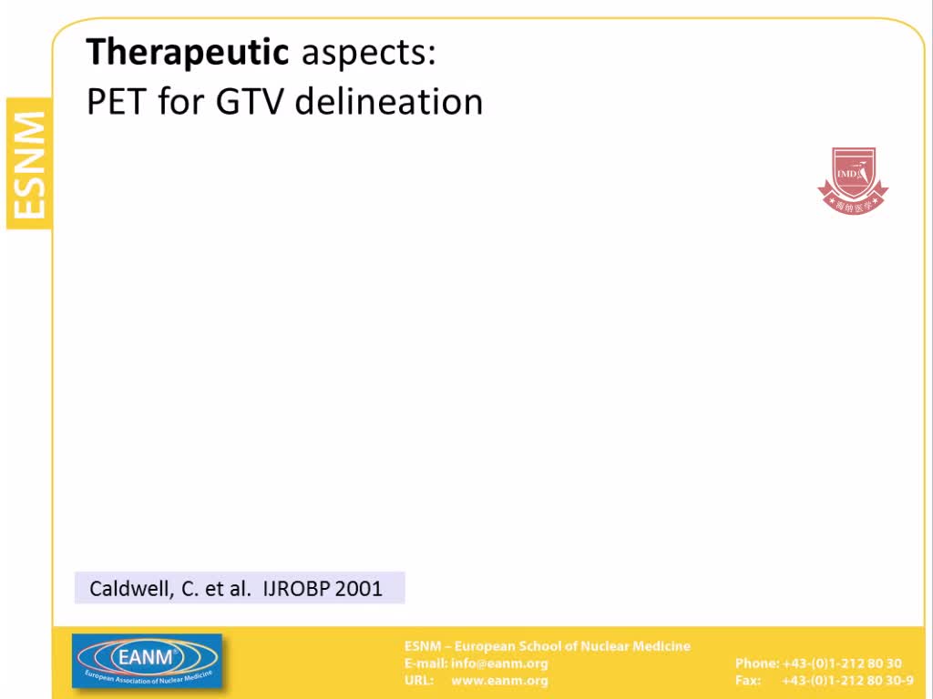 PET CT用于肺癌及其在放射治疗中的应用3