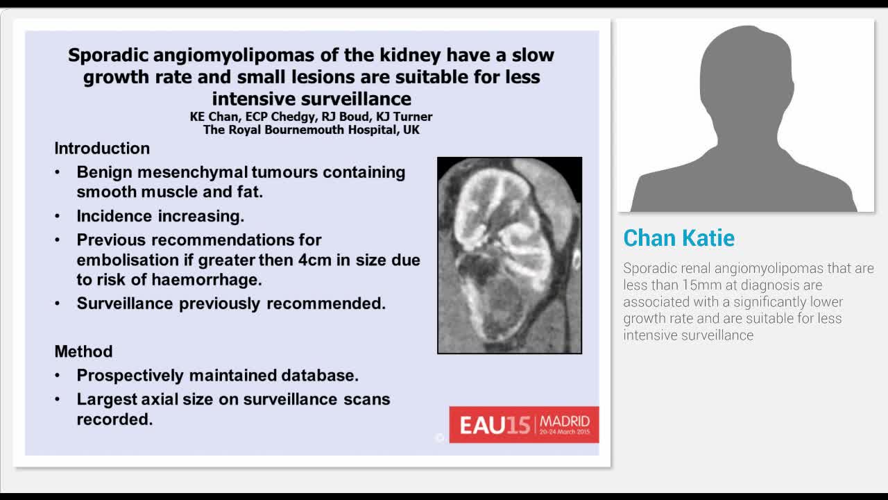 Sporadic renal angiomyolipomas that are less than 15mm at..-