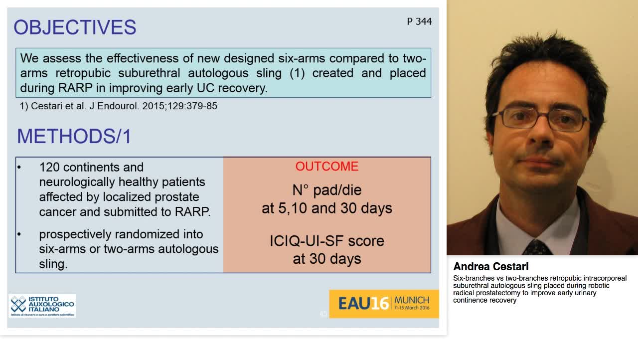 Six-branches vs two-branches retropubic intracorporeal su-