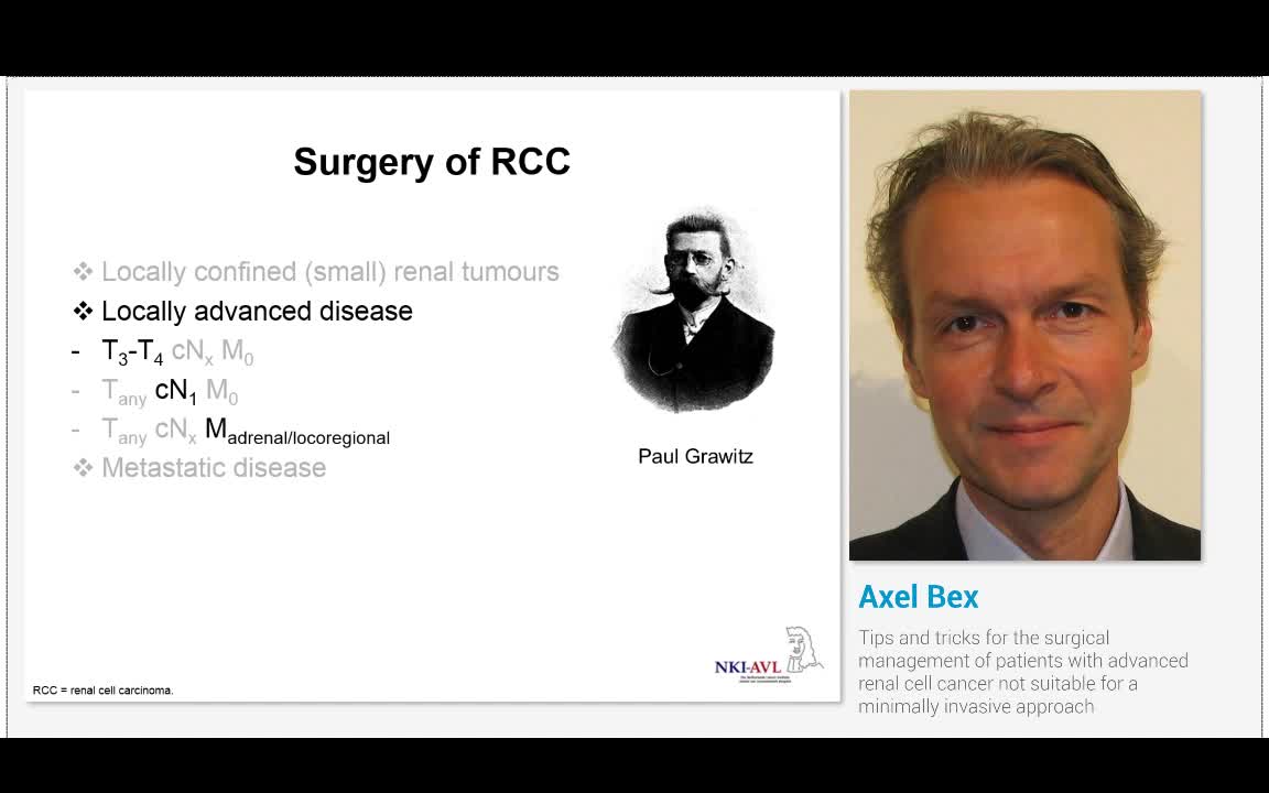 The surgical strategy for the management of renal cancer ..-