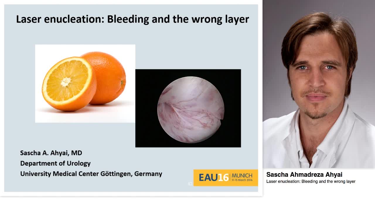 Laser enucleation, Bleeding and the wrong layer