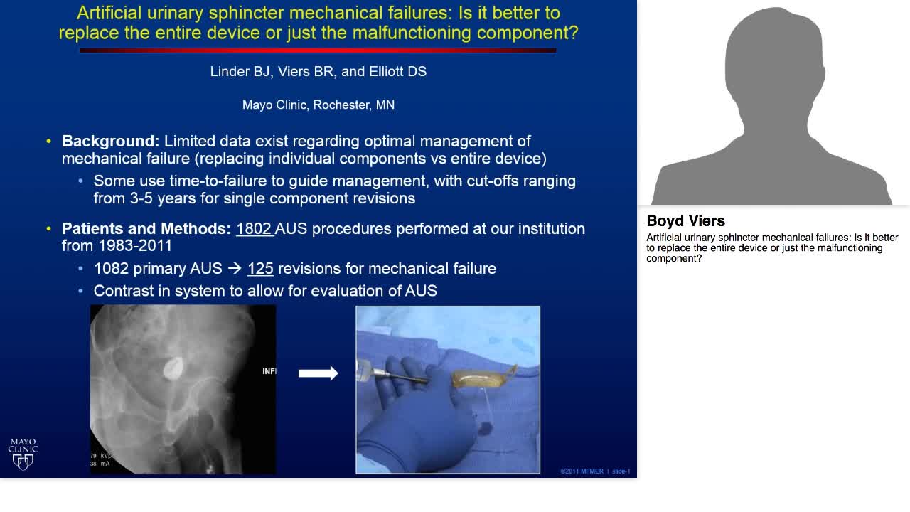 Artificial urinary sphincter mechanical failures, Is it b-
