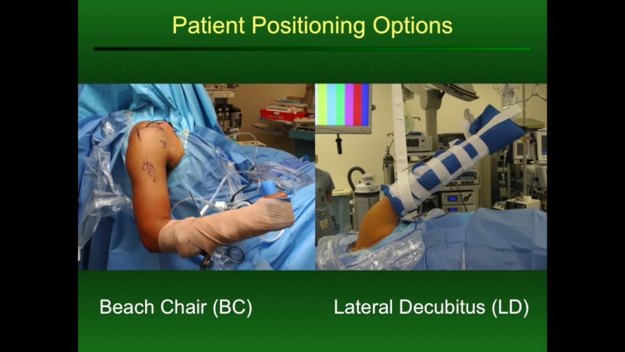 Patient Positioning in ArthroscopicShoulder Stabilization Pearls and Pitfalls