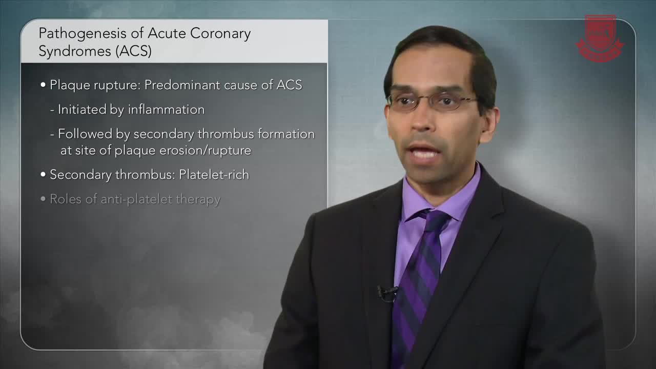 抗血小板药物用于心肌梗死病史患者血栓性心血管事件的二级预防1