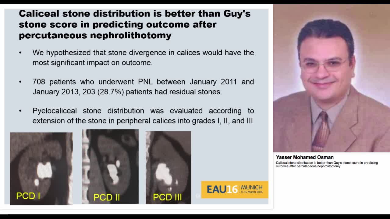 Caliceal stone distribution is better than Guy's stone sc-